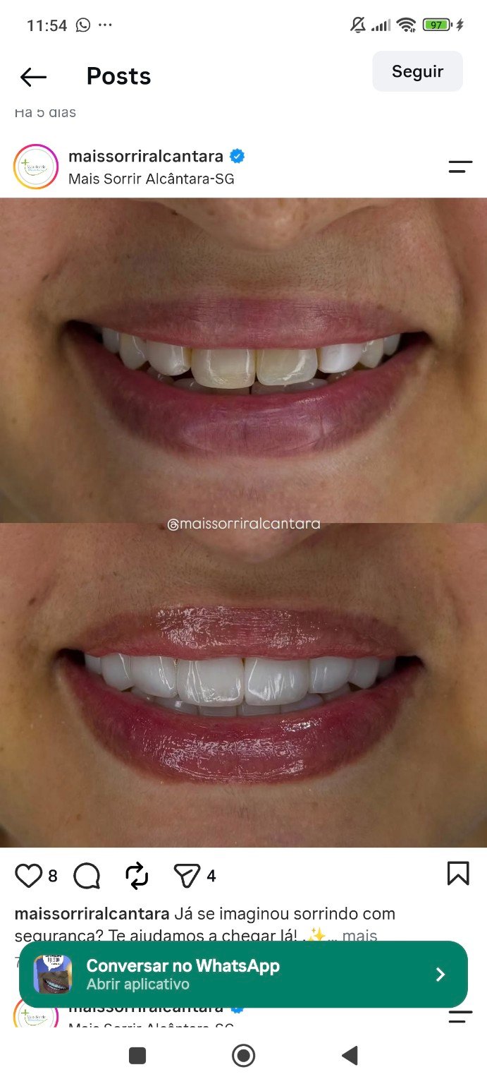 Transformação de sorriso compartilhada pela Mais Sorrir